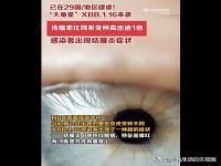 国内检出多例XBB.1.16 有结膜炎症状,究竟是怎么一回事?_在线下载网资讯