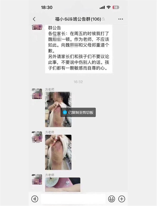 教师打伤学生后群内道歉反获多名家长安慰感谢？当地教育局介入