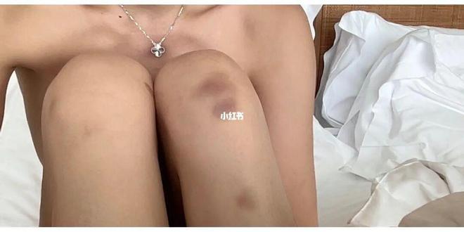 自曝“被性侵”中国女游客反驳涉事酒店声明：他们没任何沟通或道歉