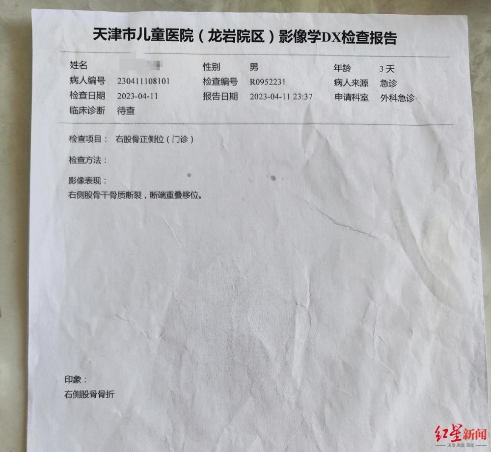 剖宫产时主刀医生把孩子大腿掰骨折却不告知家属？院方：医生已停职