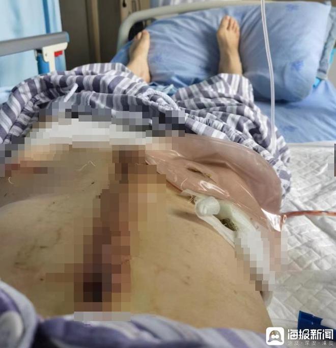 对话“两年被家暴16次”女子：为什么我逃也逃不了，离也离不掉