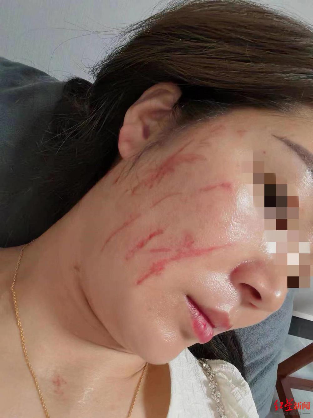 男子发视频称被家暴，其妻首次发声：他常在无监控处打孩子 男方予以否认