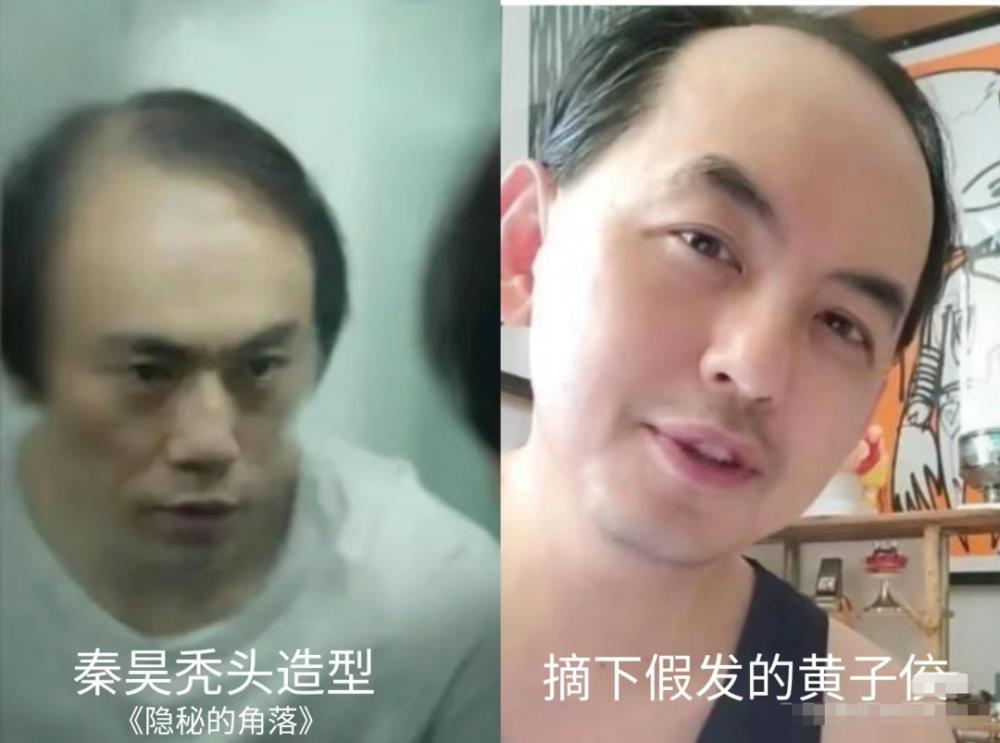秃头人最后的倔强：假发不被发现