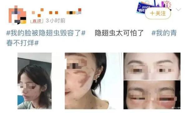 遇到这种虫子别打,究竟是怎么一回事?