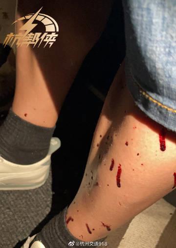 杭州夫妇亲述在法遭遇：多名蒙面暴徒拿石头砸车，中国游客被砸伤