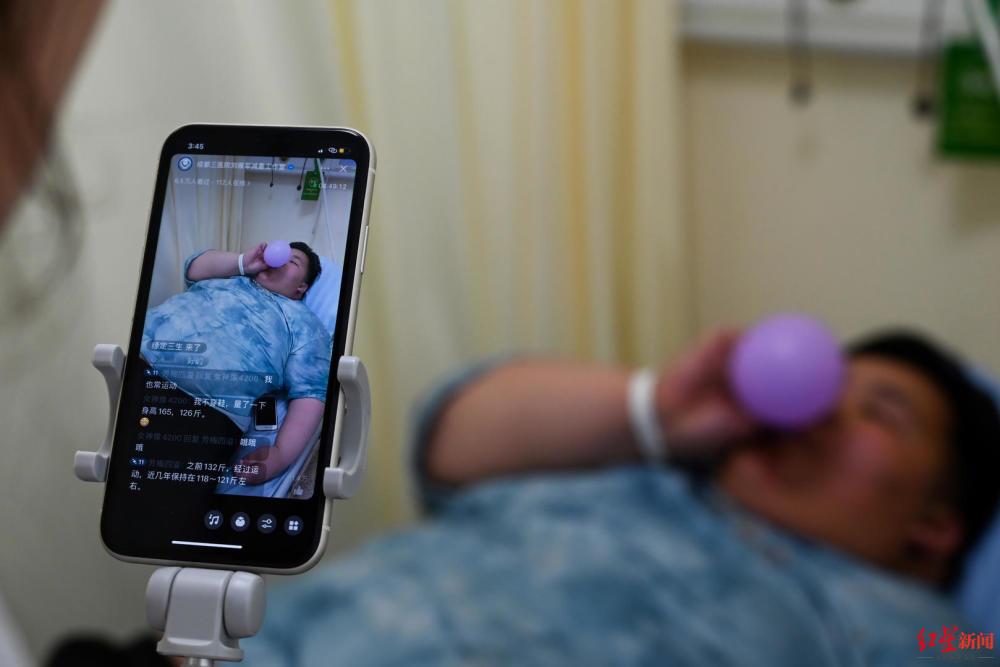 四川姐弟俩总体重超800斤，一起接受手术减重 医生：BMI超28应尽早干预