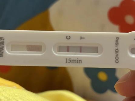 女子自述5次感染新冠:仍活蹦乱跳,要用平常心看待