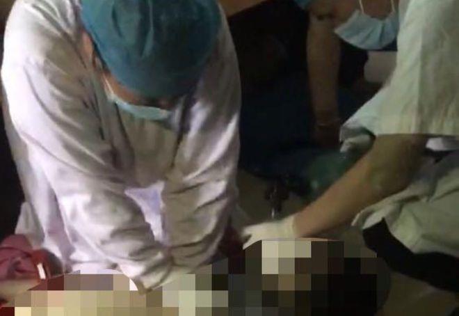 家里突然电费猛增？女子“死里逃生”后晒图：都发黑了！曾有人不幸身亡