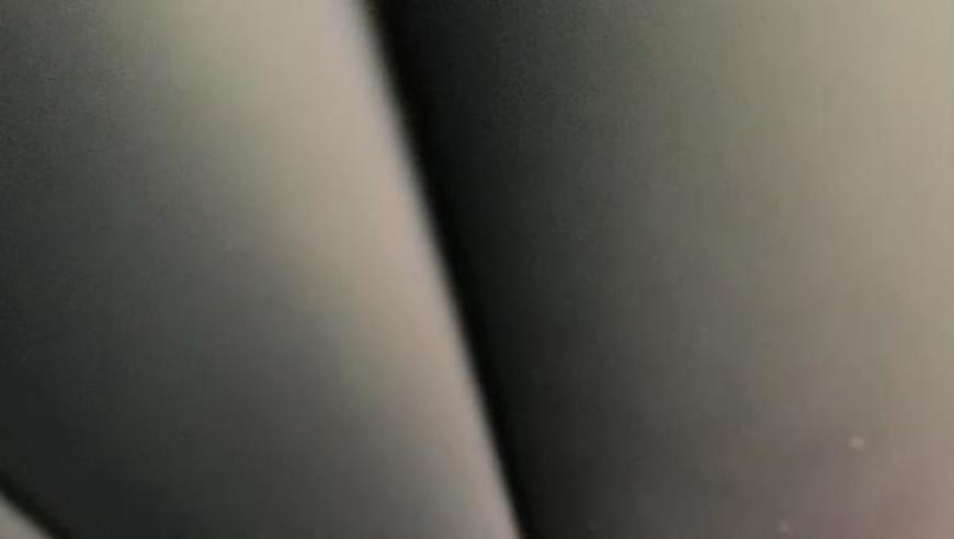 李梦自曝受伤：膝盖肿胀弯腿伸直达不到角度 卷裤腿遮赞助商真相出炉